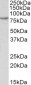 CRTC2 (aa542-553) Antibody (internal region)